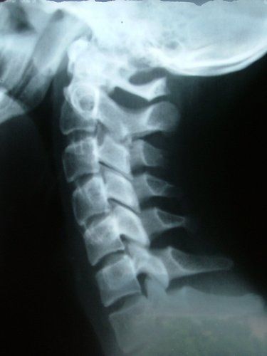 initial-visit-spine-x-ray-tn